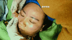 西安學(xué)微整形學(xué)費(fèi)多少(西安哪里可以學(xué)微整形)