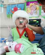 后腦勺整形需要多少歲(后腦勺整形多少歲能做)