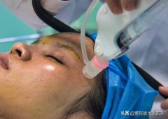 汽車(chē)輕微整形多少錢(qián)(微型整容要多少錢(qián))