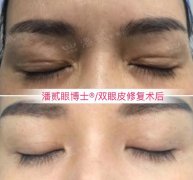 區(qū)整形美容手術(shù)多少錢(qián)(整形美容手術(shù)價(jià)格)