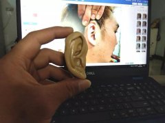 耳朵畸形整形價(jià)格多少錢(qián)(耳朵畸形整形價(jià)格多少錢(qián)一次)