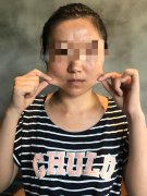 溫州下顎整形醫(yī)院費(fèi)用多少(溫州整形美容醫(yī)院費(fèi)用)