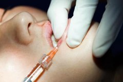 蘭州時(shí)光整形隆鼻多少錢(qián)(蘭州時(shí)光整形割雙眼皮多少錢(qián))