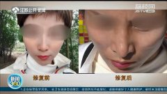 整形醫(yī)院的手術(shù)費(fèi)用多少(整形醫(yī)院需要多少錢(qián))