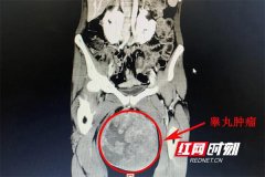 整形丸一盒多少錢(丸子減肥藥多少錢一瓶)